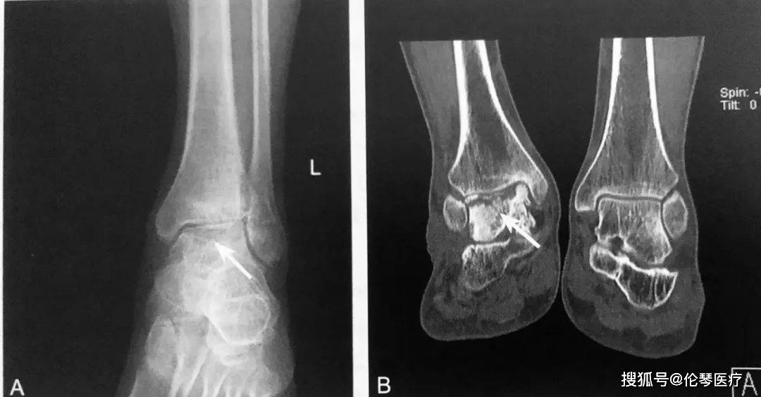 99久久久国产精品免费无卡顿:07-20-21-23-25-41C：07,探索国产精品的魅力，免费无卡顿体验与深度解析